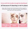 Ultrasonic Peeling Machine - Multifunctional Facial Blackhead Peeling Instrument - Pink